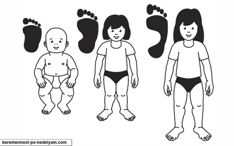 Ребенок 1 год и 4 месяца плоскостопие