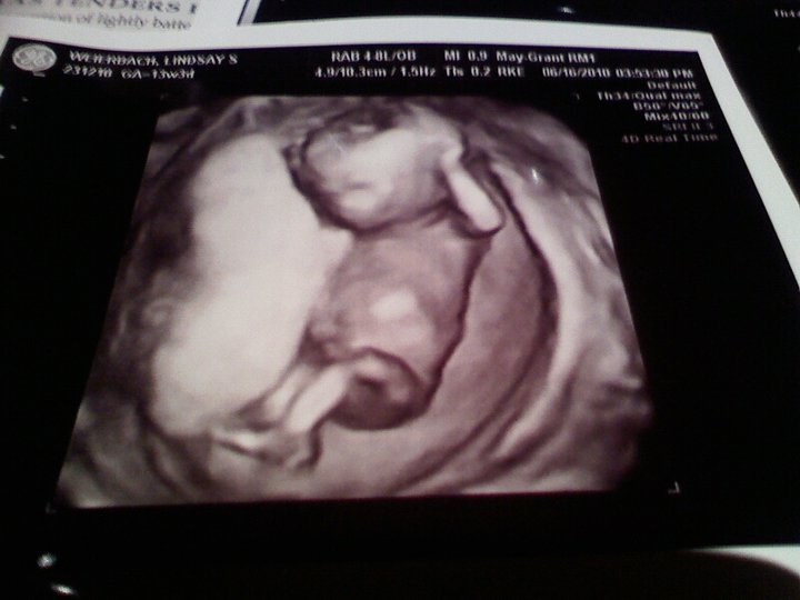 Фото ребенка на 14 неделе беременности фото