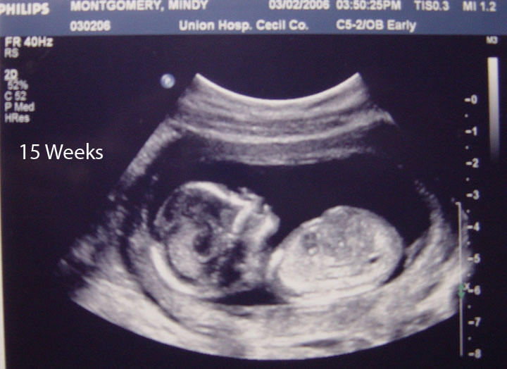 Узи ребенка 15 недель беременности фото