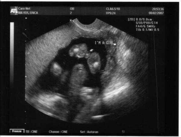 Фото ребенка на узи на 19 неделе беременности