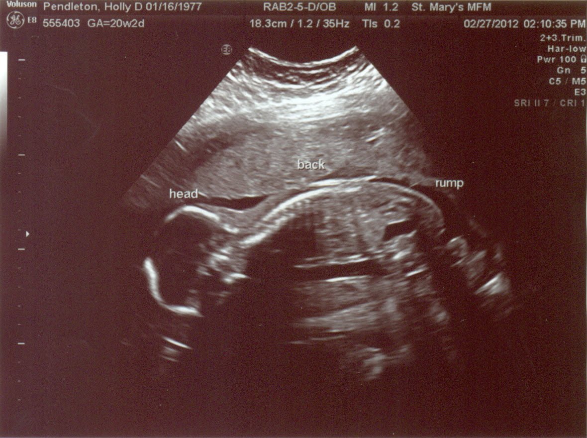 36 недель беременности фото ребенка в утробе