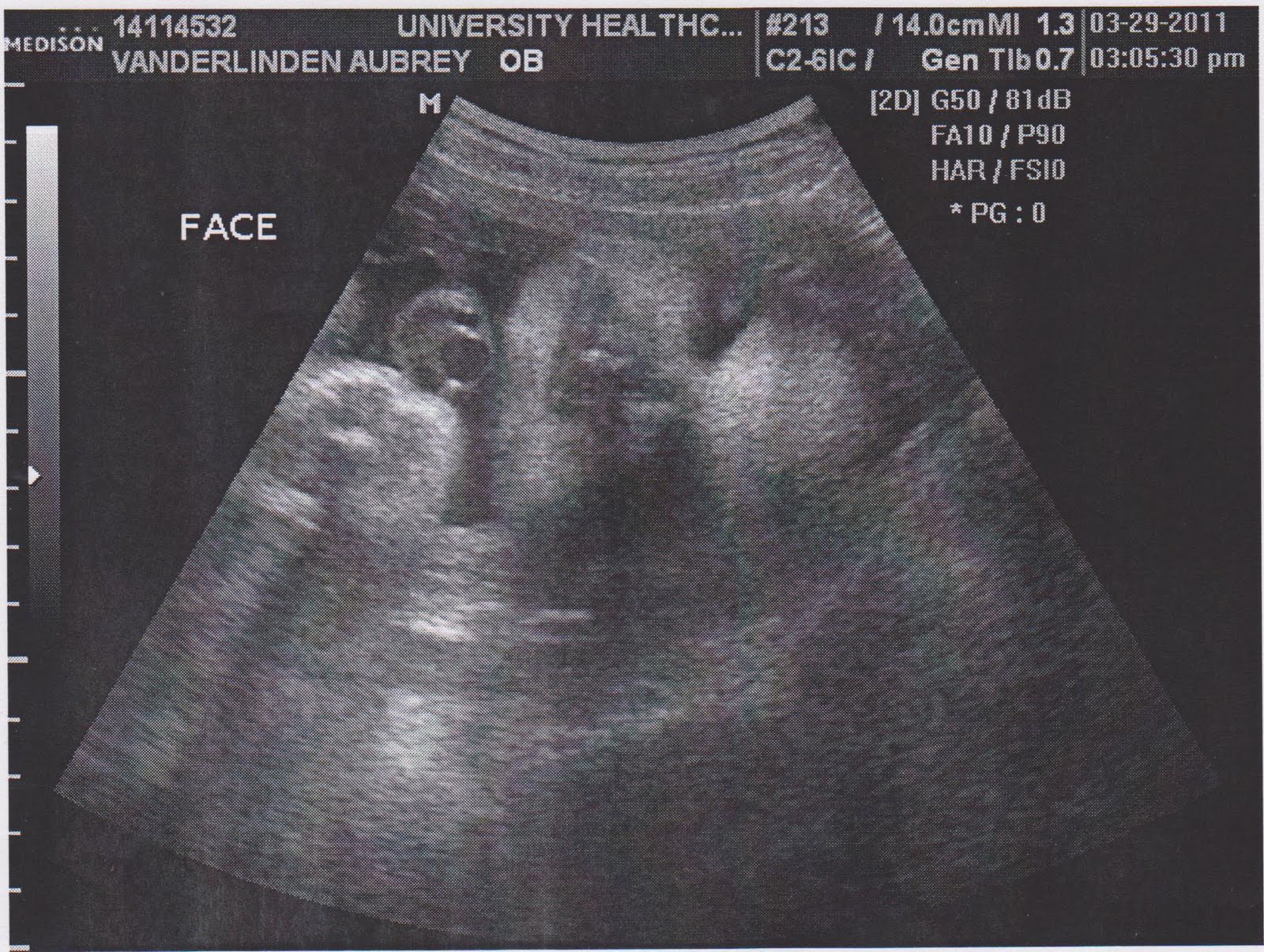 30 неделя беременности фото ребенка