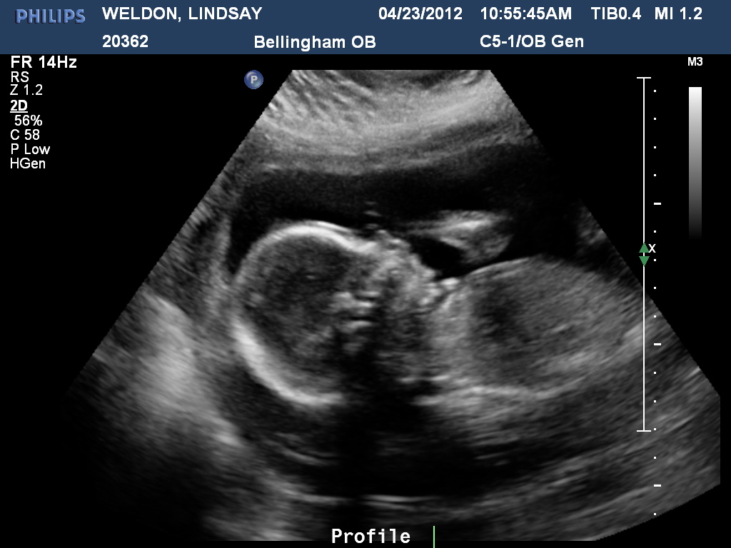 12 недель беременности что есть. Фото малыша на 20 неделе беременности УЗИ. 20 Недель беременности фото плода на УЗИ. УЗИ ребенка 20 недель фото.