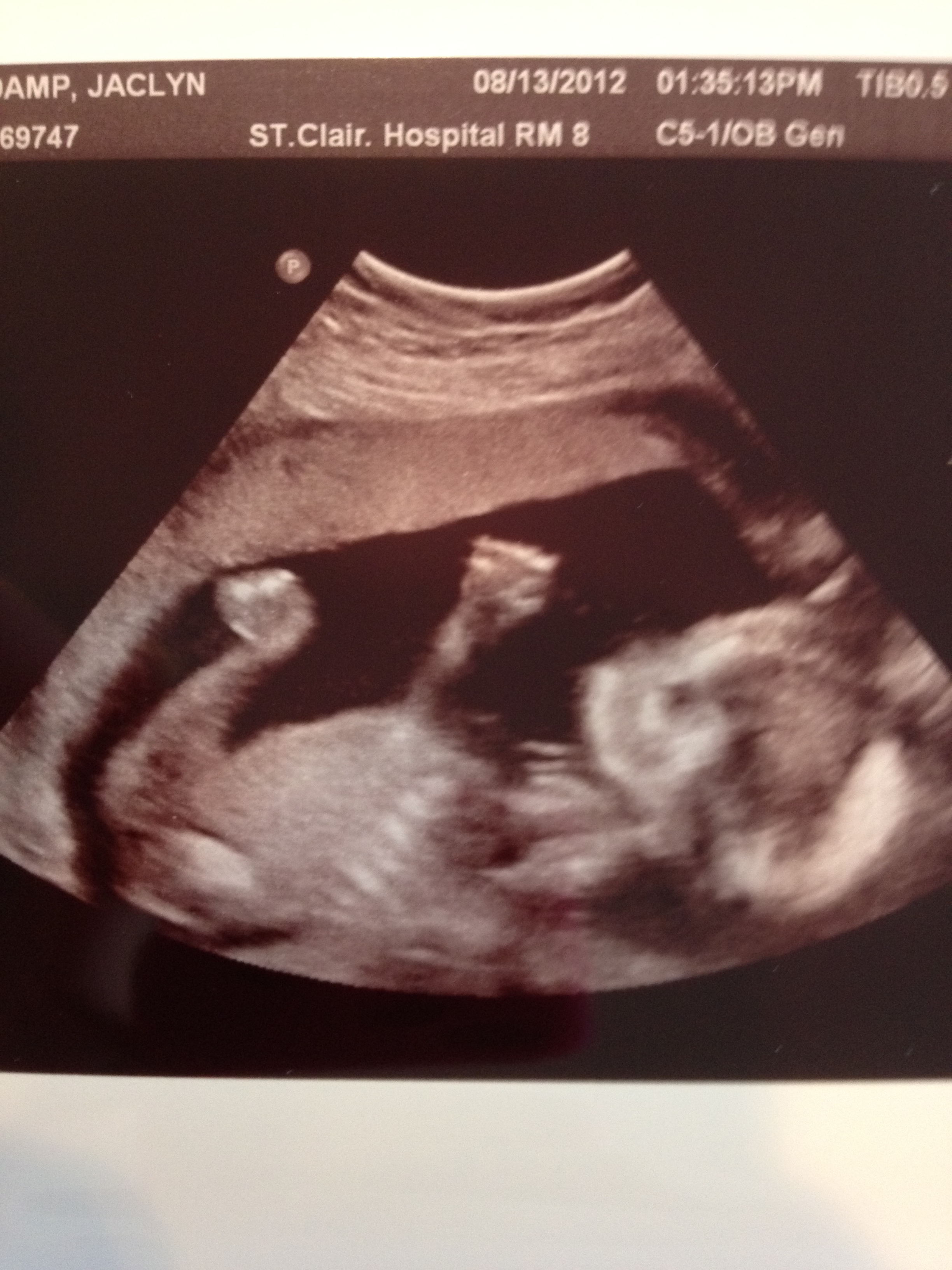 22 недели беременности фото узи