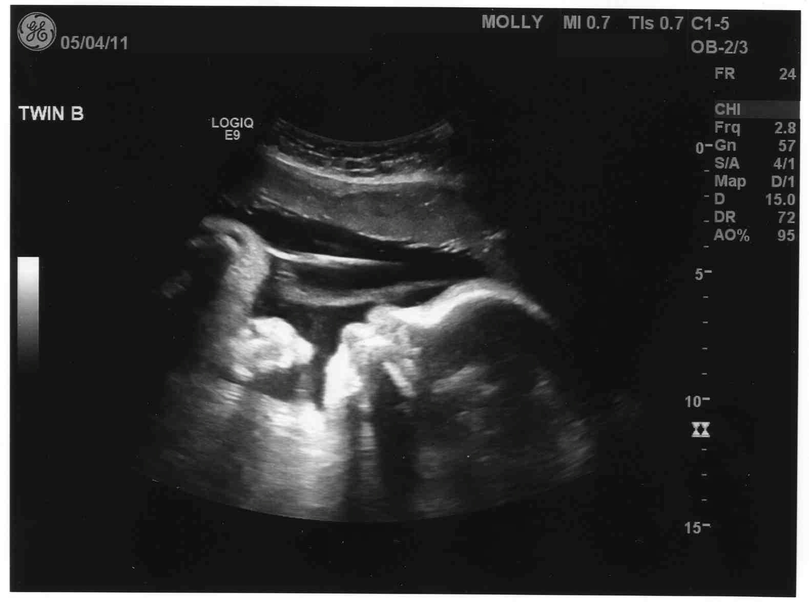 Фото 36 недель беременности фото