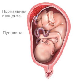 Плацента при беременности, низкая плацента при беременности